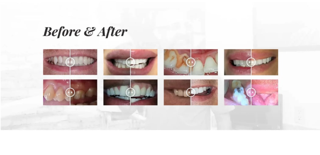 Stara wersja strony internetowej klinki dentystycznej Smile LA, sekcja przedstawiająca rezultaty przed i po